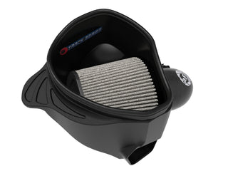 Takeda Track Series Carbon Fiber Cold Air Intake System w/Pro DRY S Filter: Toyota GR Supra 2.0L Turbo 2021 - 2024